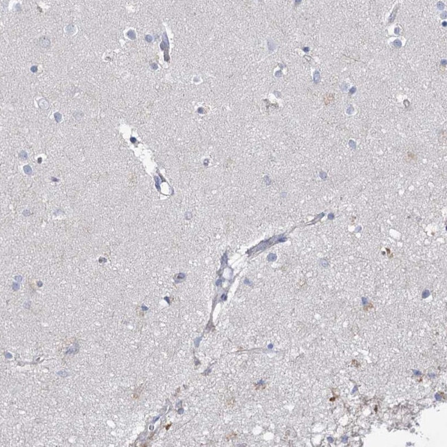 ECHDC3 Antibody in Immunohistochemistry (IHC)