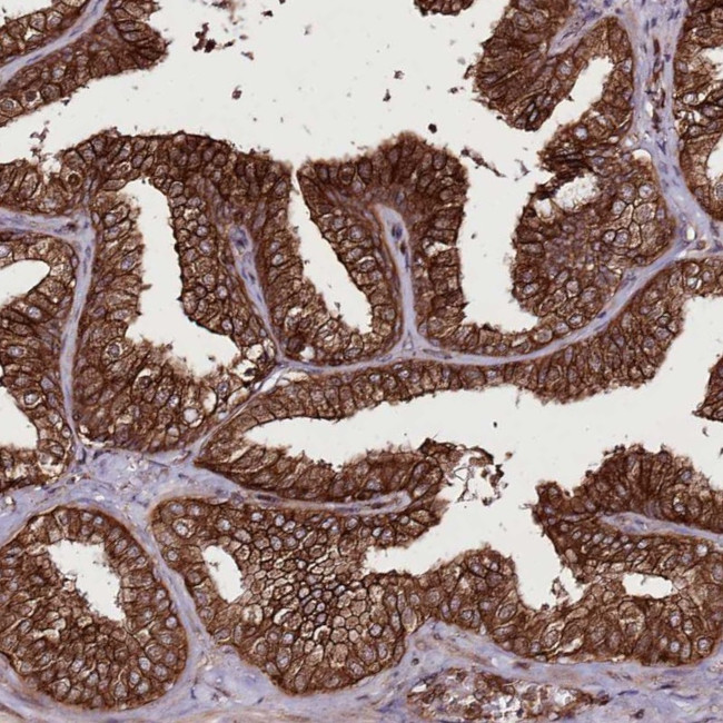 DHX29 Antibody in Immunohistochemistry (IHC)