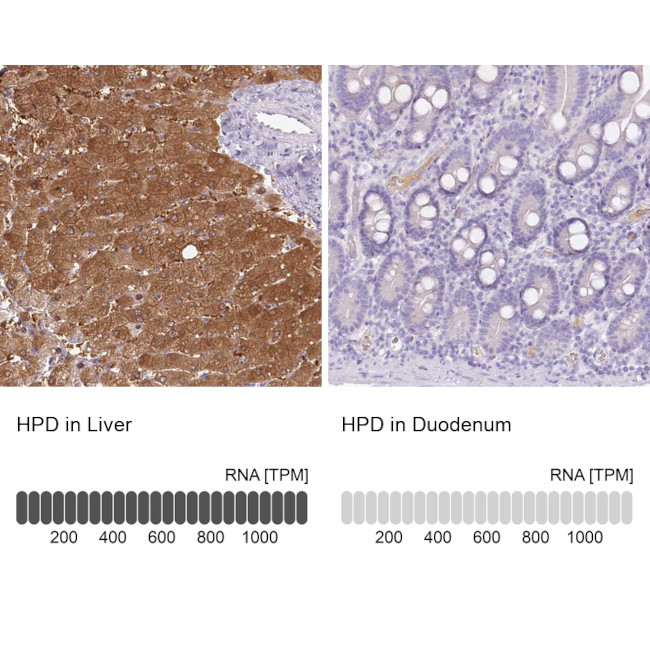 HPD Antibody in Immunohistochemistry (IHC)