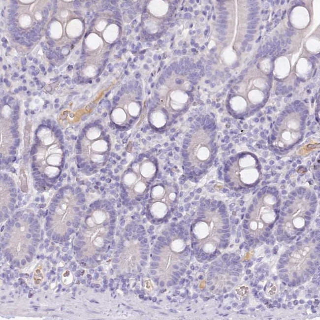 HPD Antibody in Immunohistochemistry (IHC)