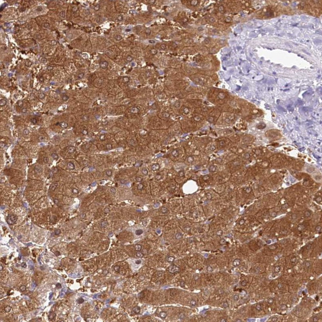 HPD Antibody in Immunohistochemistry (IHC)