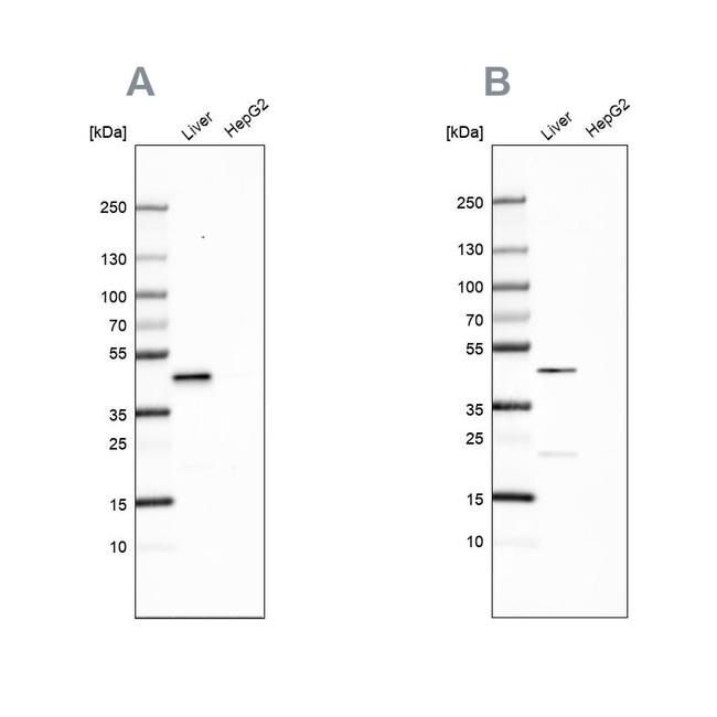 HPD Antibody in Western Blot (WB)