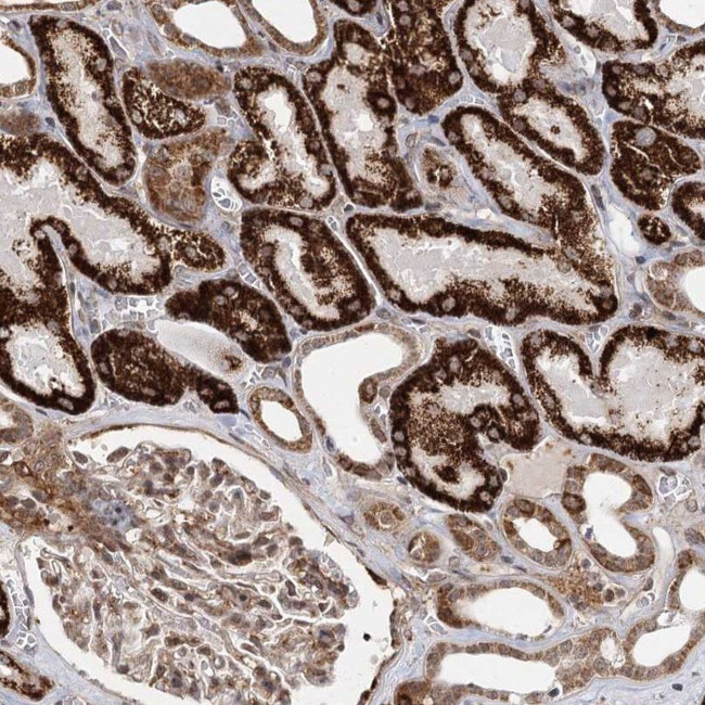 ZCCHC24 Antibody in Immunohistochemistry (IHC)