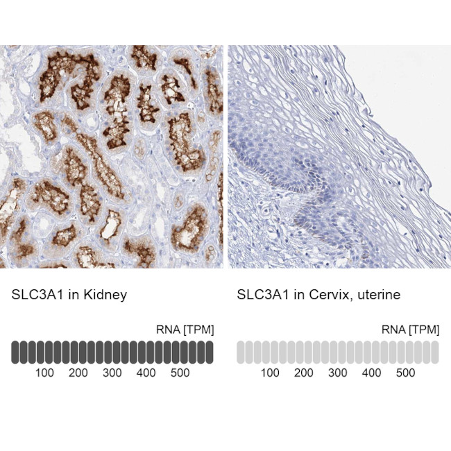 SLC3A1 Antibody in Immunohistochemistry (IHC)