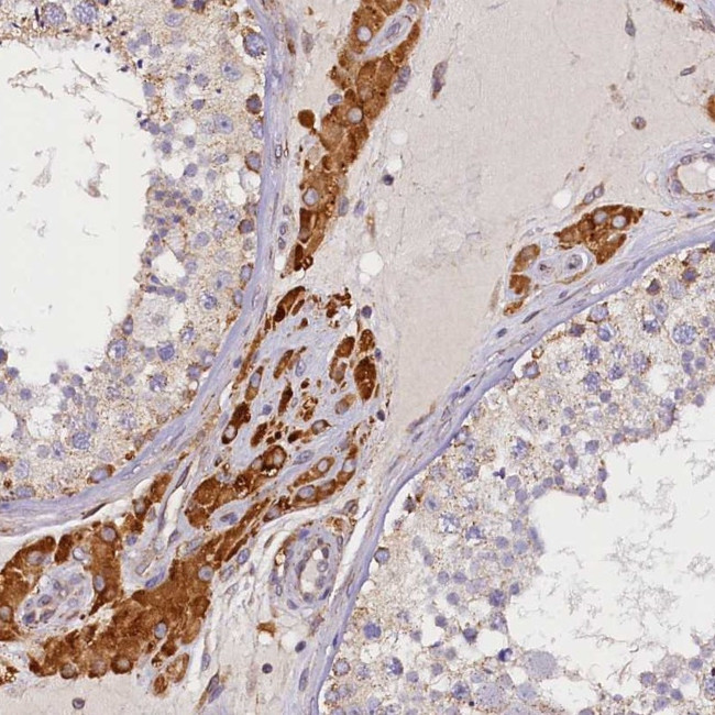 SUPV3L1 Antibody in Immunohistochemistry (IHC)