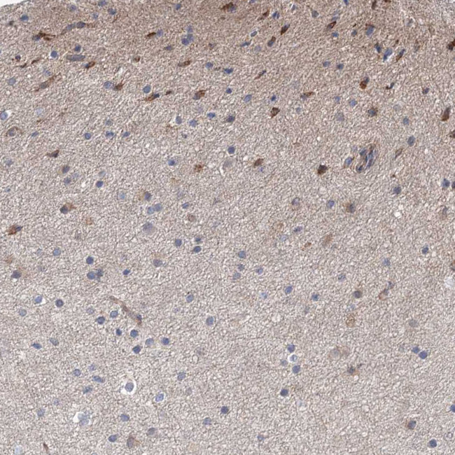 GRF-1 Antibody in Immunohistochemistry (IHC)