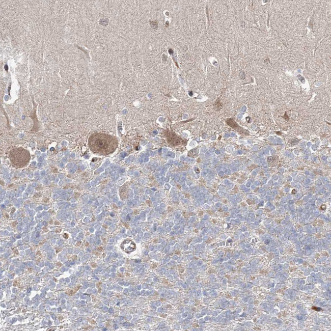 GRF-1 Antibody in Immunohistochemistry (IHC)