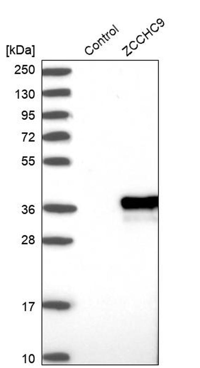 ZCCHC9 Antibody in Western Blot (WB)