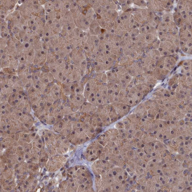 SUPV3L1 Antibody in Immunohistochemistry (IHC)