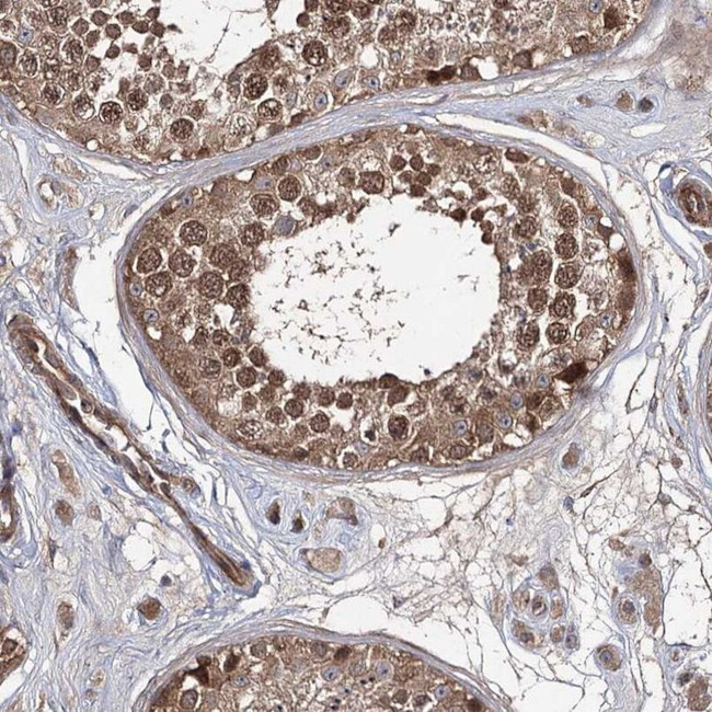 WDR48 Antibody in Immunohistochemistry (IHC)