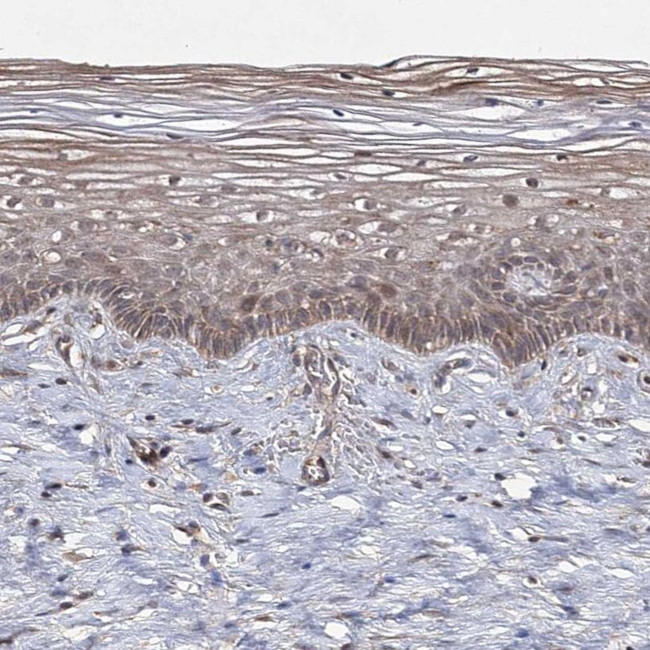 WDR48 Antibody in Immunohistochemistry (IHC)