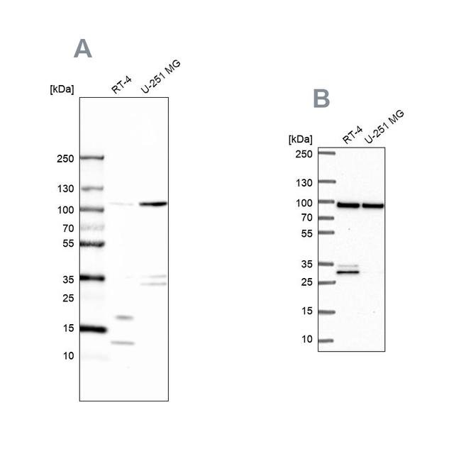 WDR48 Antibody in Western Blot (WB)