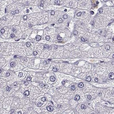 BFSP2 Antibody in Immunohistochemistry (IHC)