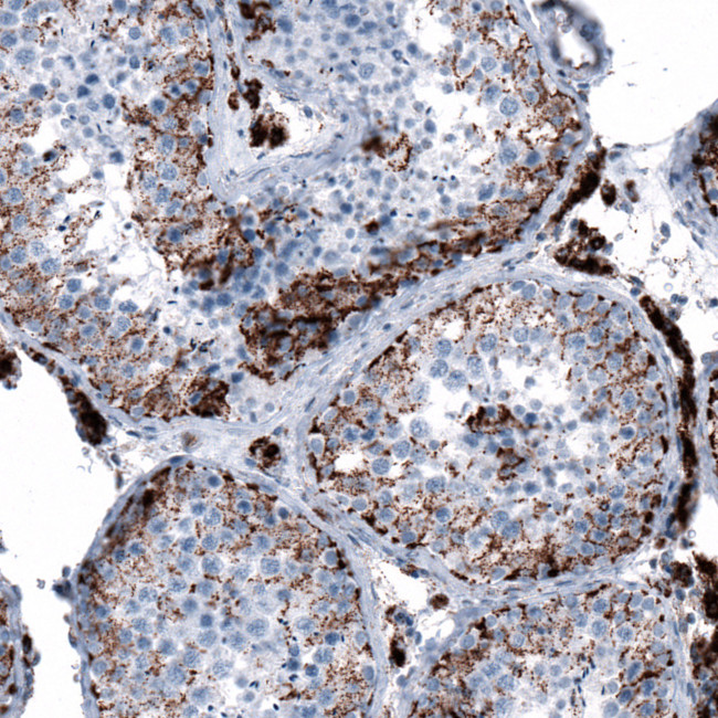 ME3 Antibody in Immunohistochemistry (IHC)