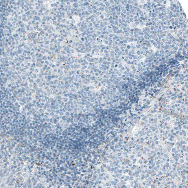 ME3 Antibody in Immunohistochemistry (IHC)