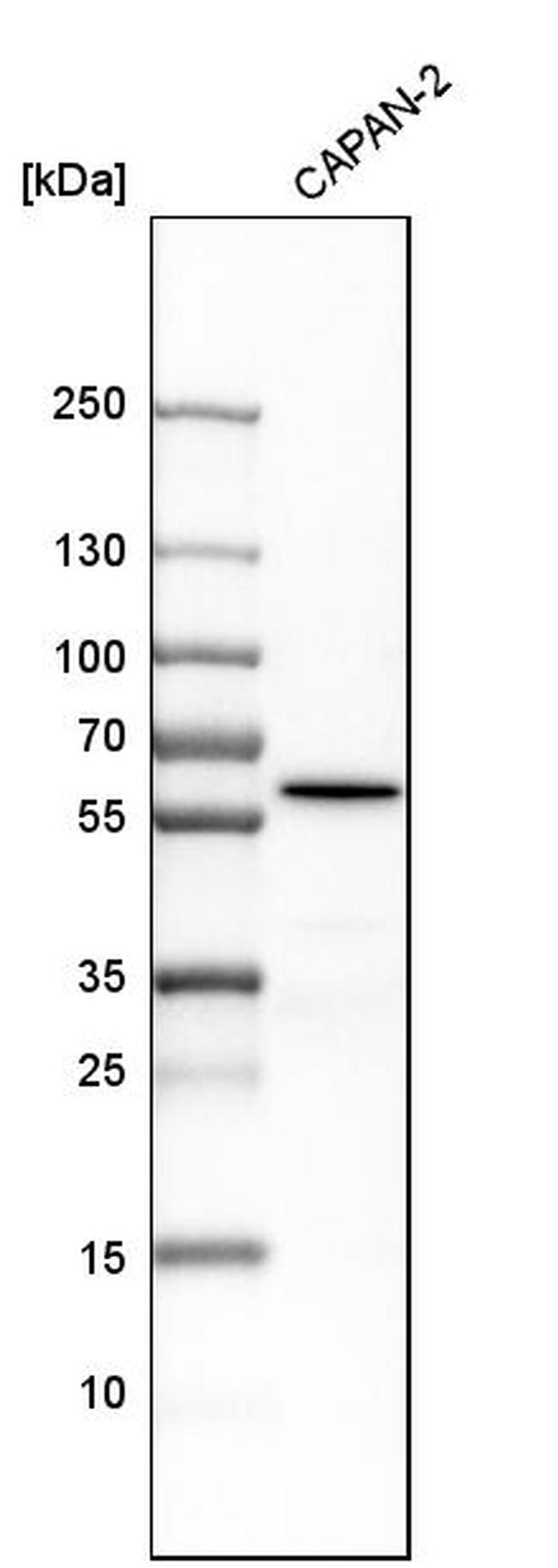 ME3 Antibody in Western Blot (WB)