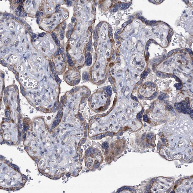 MCMBP Antibody in Immunohistochemistry (IHC)