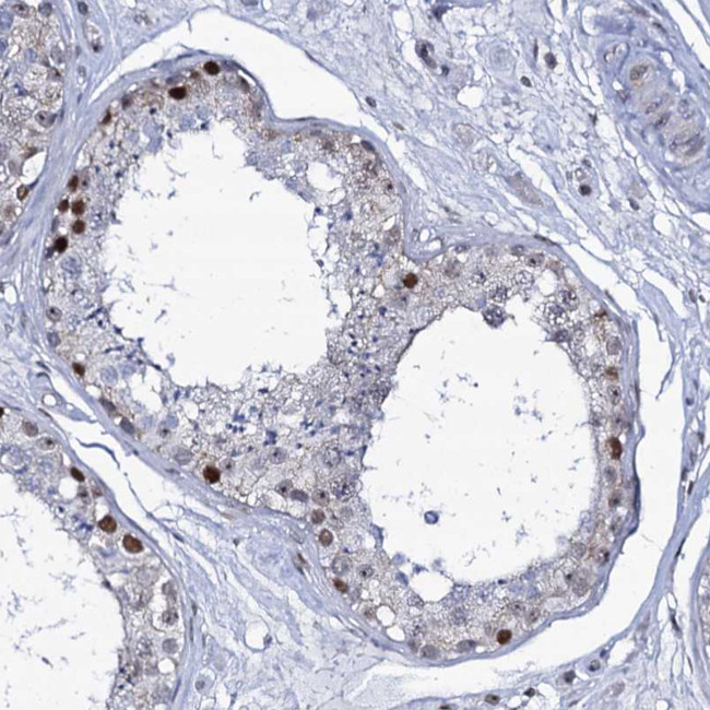 MCMBP Antibody in Immunohistochemistry (IHC)