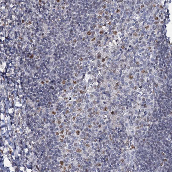 MCMBP Antibody in Immunohistochemistry (IHC)