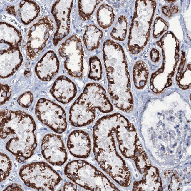 MRPS35 Antibody in Immunohistochemistry (IHC)