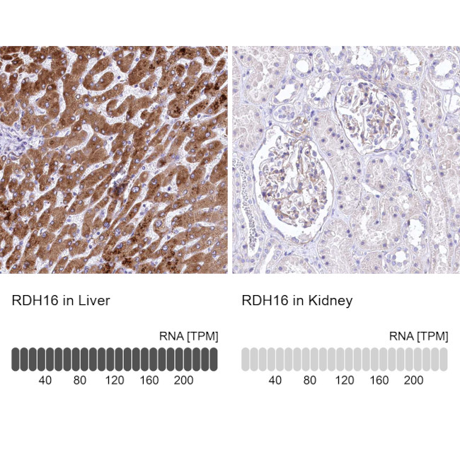 RDH16 Antibody in Immunohistochemistry (IHC)