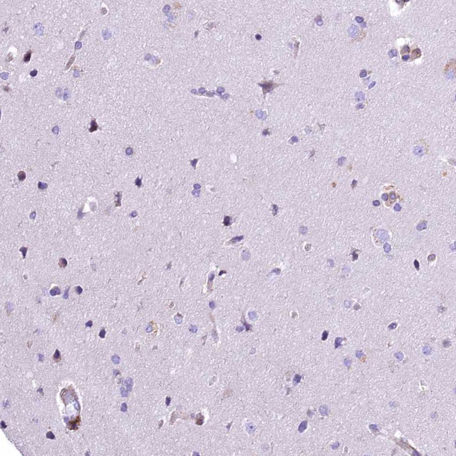 RDH16 Antibody in Immunohistochemistry (IHC)