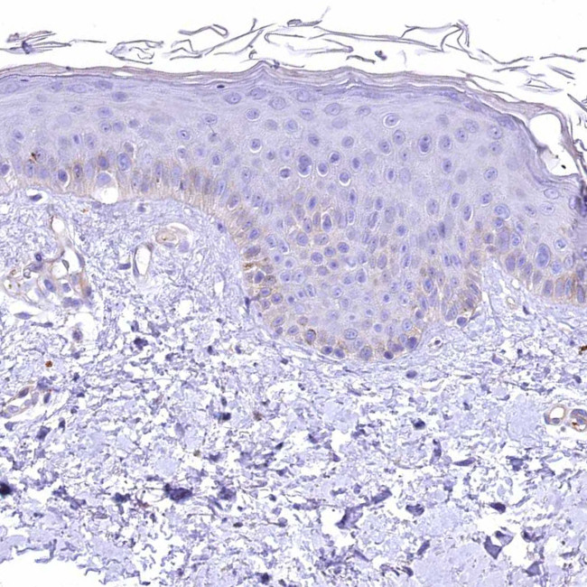 RDH16 Antibody in Immunohistochemistry (IHC)