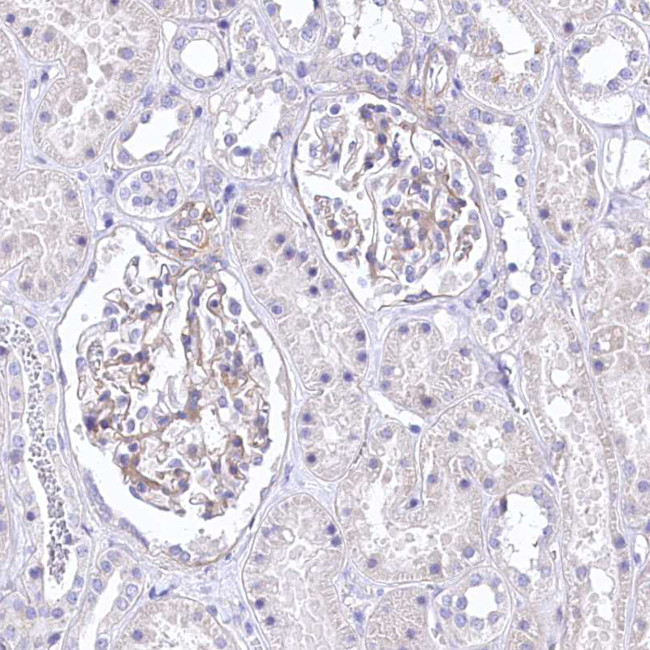 RDH16 Antibody in Immunohistochemistry (IHC)