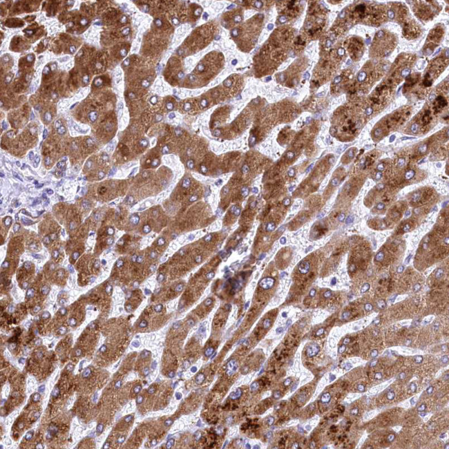 RDH16 Antibody in Immunohistochemistry (IHC)