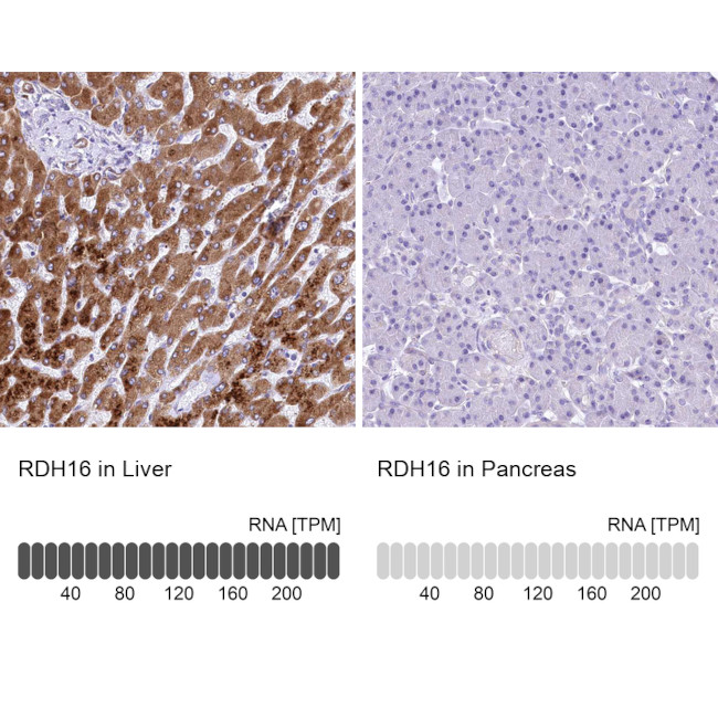 RDH16 Antibody