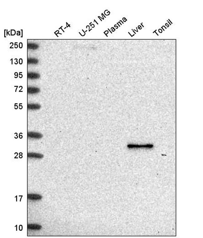 RDH16 Antibody in Western Blot (WB)