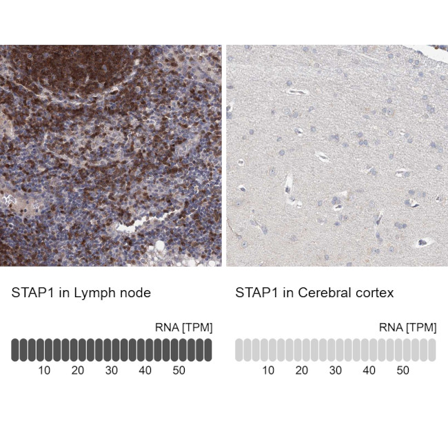 STAP1 Antibody in Immunohistochemistry (IHC)