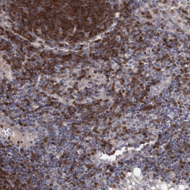 STAP1 Antibody in Immunohistochemistry (IHC)