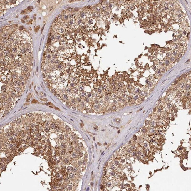 TTC12 Antibody in Immunohistochemistry (IHC)