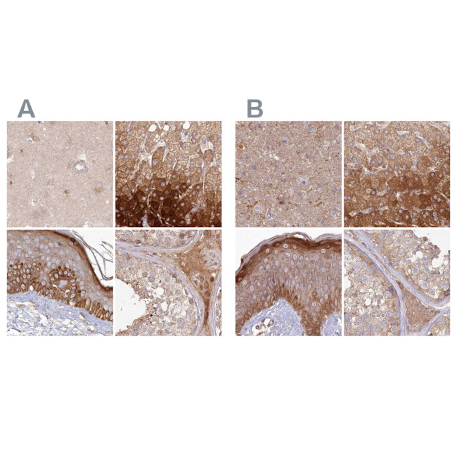 HAL Antibody in Immunohistochemistry (IHC)