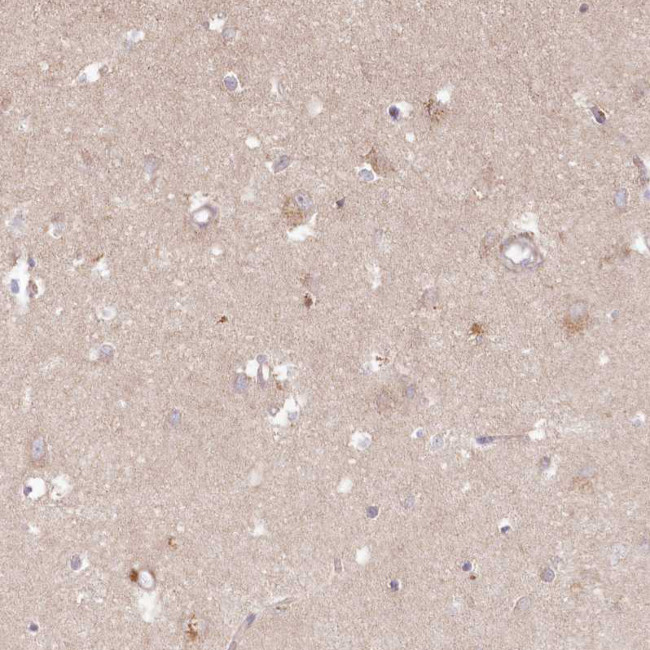 HAL Antibody in Immunohistochemistry (IHC)