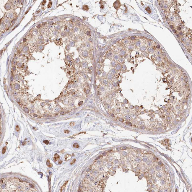 HAL Antibody in Immunohistochemistry (IHC)