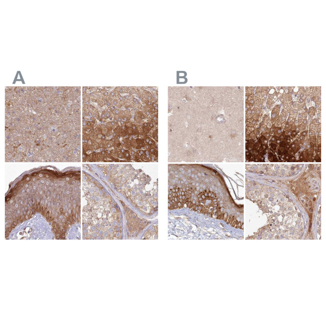 HAL Antibody in Immunohistochemistry (IHC)