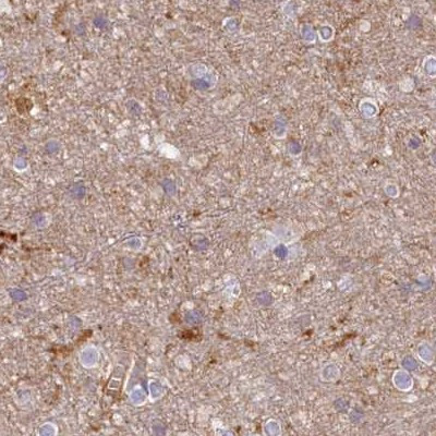 HAL Antibody in Immunohistochemistry (IHC)