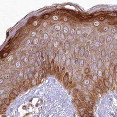 HAL Antibody in Immunohistochemistry (IHC)