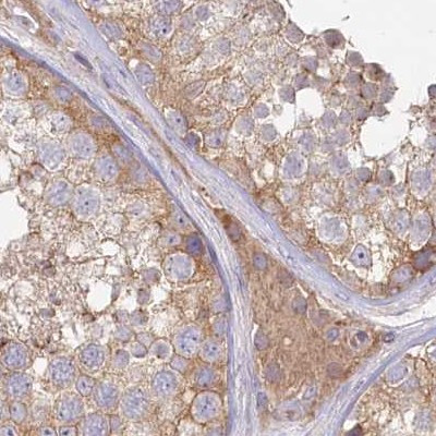 HAL Antibody in Immunohistochemistry (IHC)