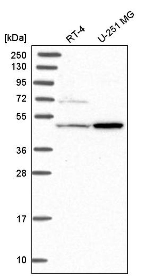 HAL Antibody in Western Blot (WB)