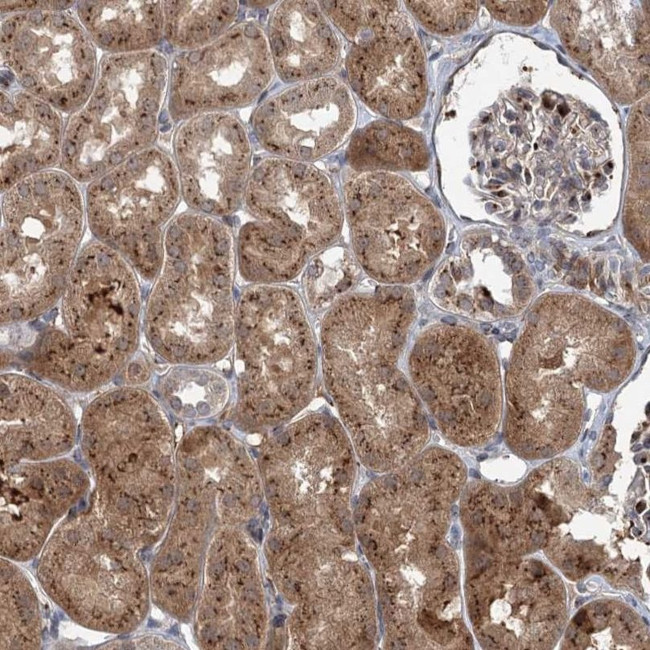 ELP4 Antibody in Immunohistochemistry (IHC)