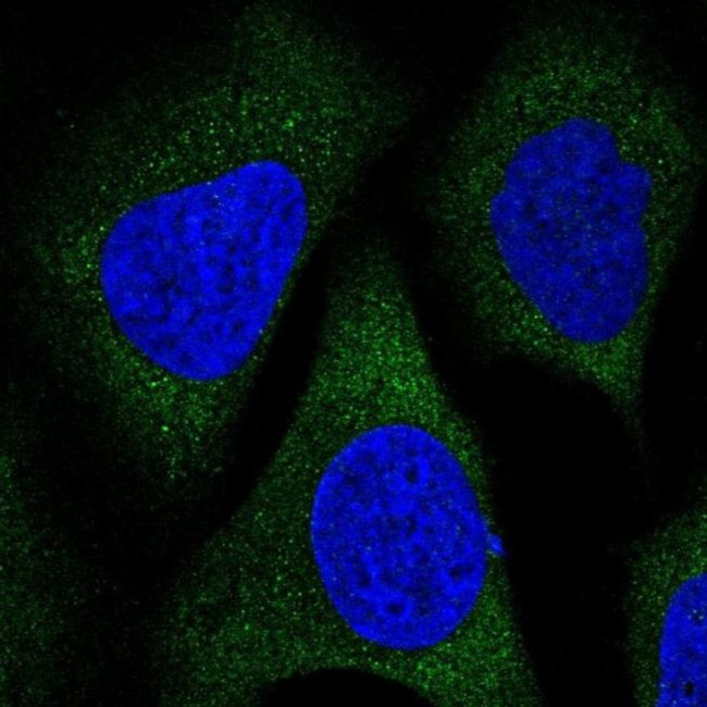 TBCEL Antibody in Immunocytochemistry (ICC/IF)