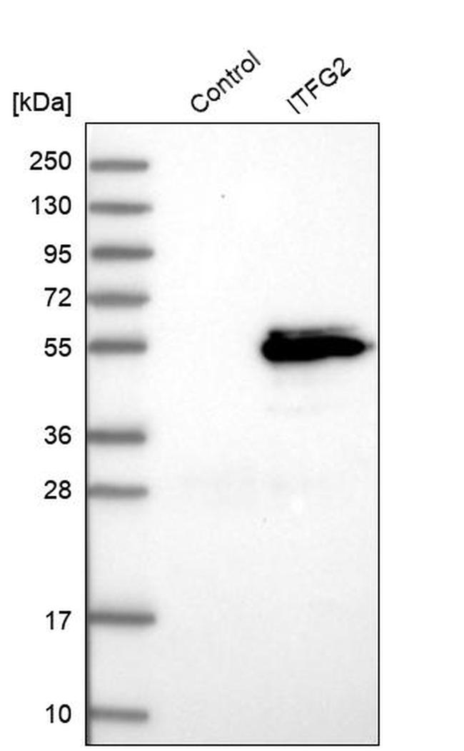 ITFG2 Antibody in Western Blot (WB)