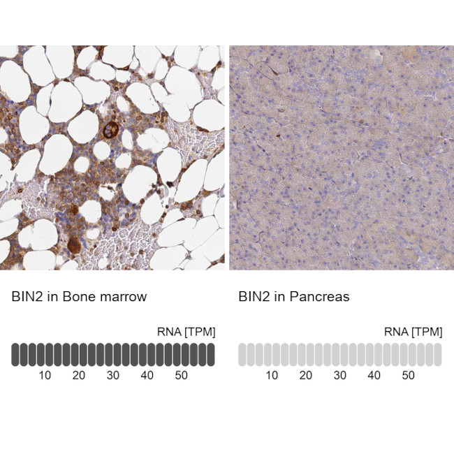 BIN2 Antibody in Immunohistochemistry (IHC)