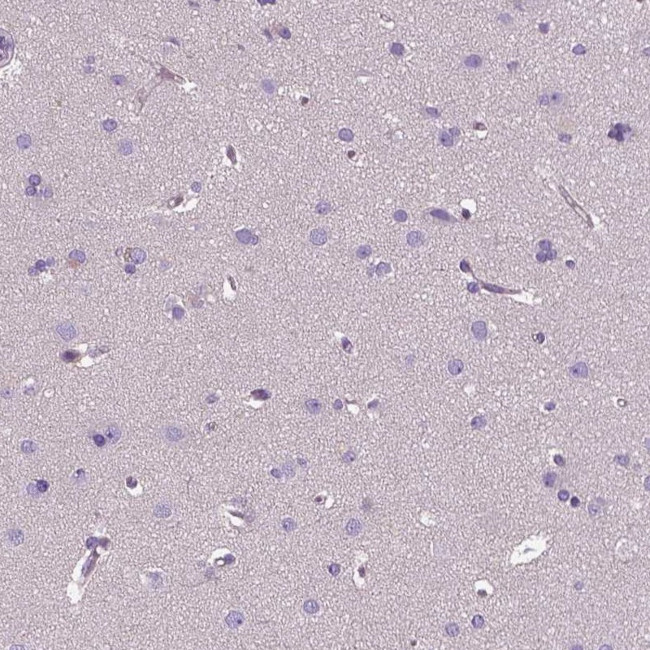 EFCAB4B Antibody in Immunohistochemistry (IHC)