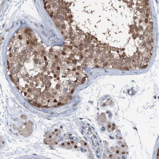 PSMD13 Antibody in Immunohistochemistry (IHC)