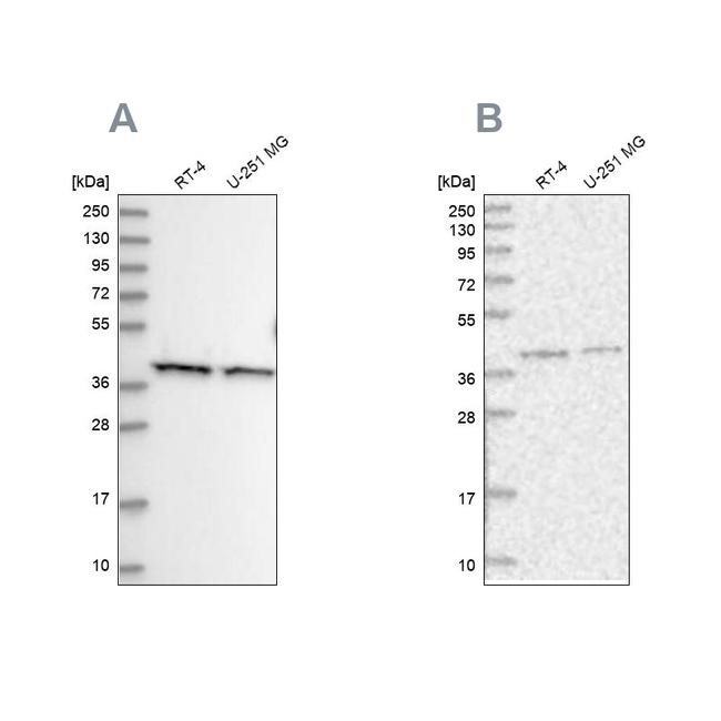 PSMD13 Antibody in Western Blot (WB)