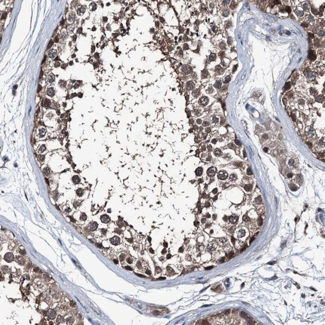 PSMD13 Antibody in Immunohistochemistry (IHC)